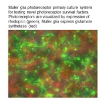 High throughput drug discovery for identifying neuroprotective factors