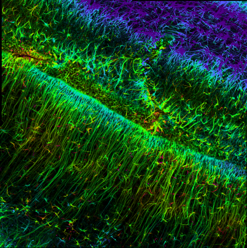 Example: XYZ image Dr. Pearse lab