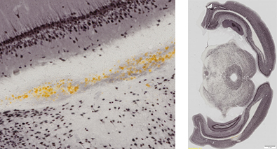 Example: Brightfield image of mouse brain Dr. Atkins lab 