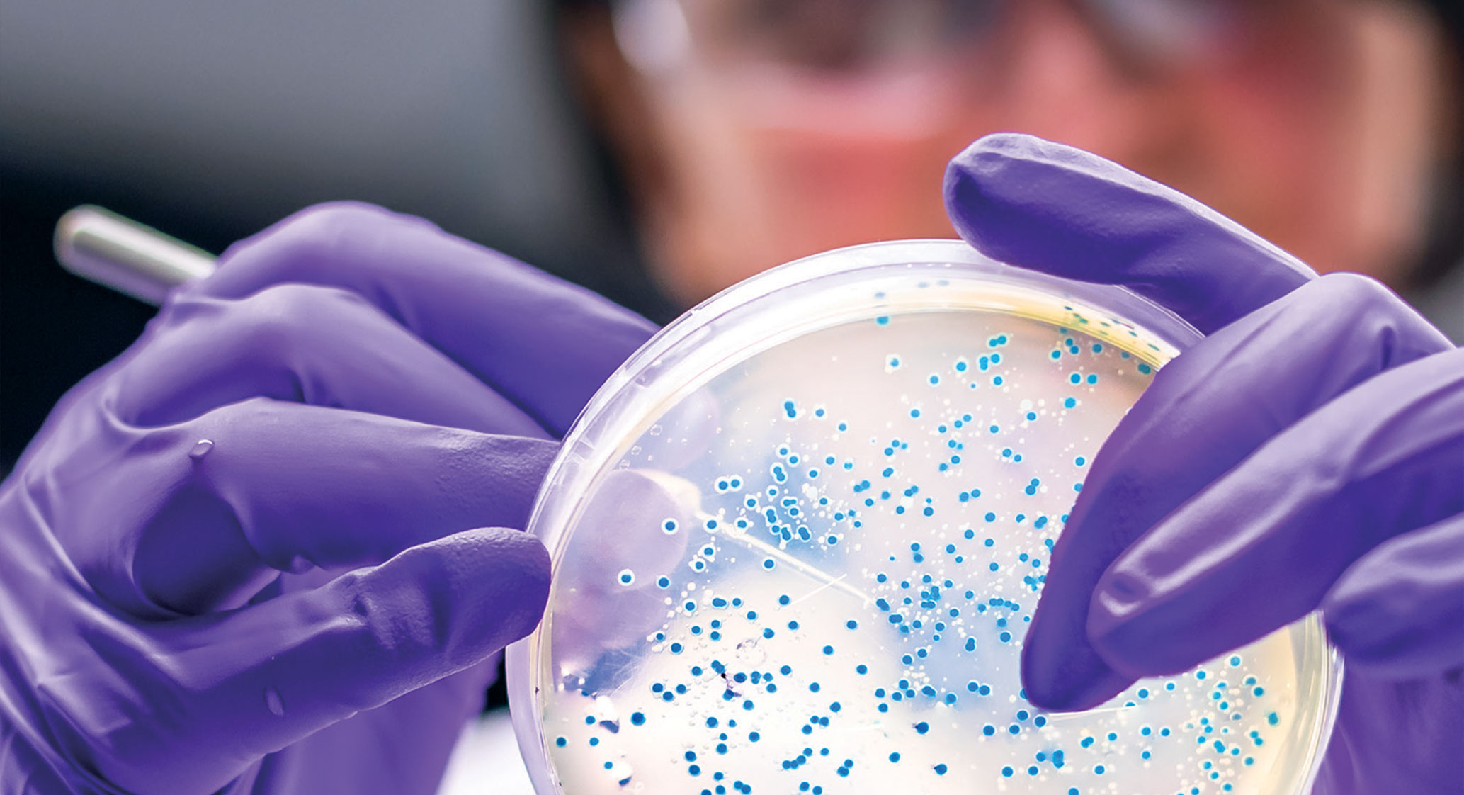 Scientist looking at growth in a petri dish